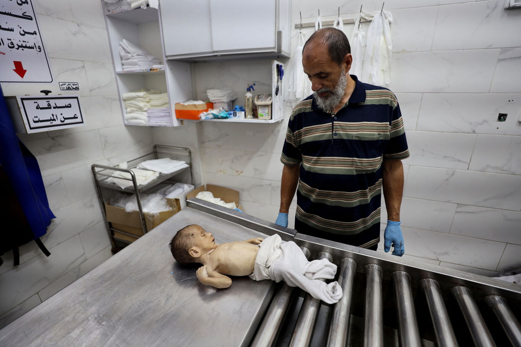 ISRAEL-PALESTINIANS/GAZA-HUNGER